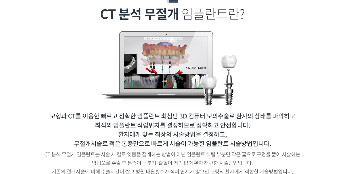 ct�м� ������ ���ö�Ʈ��