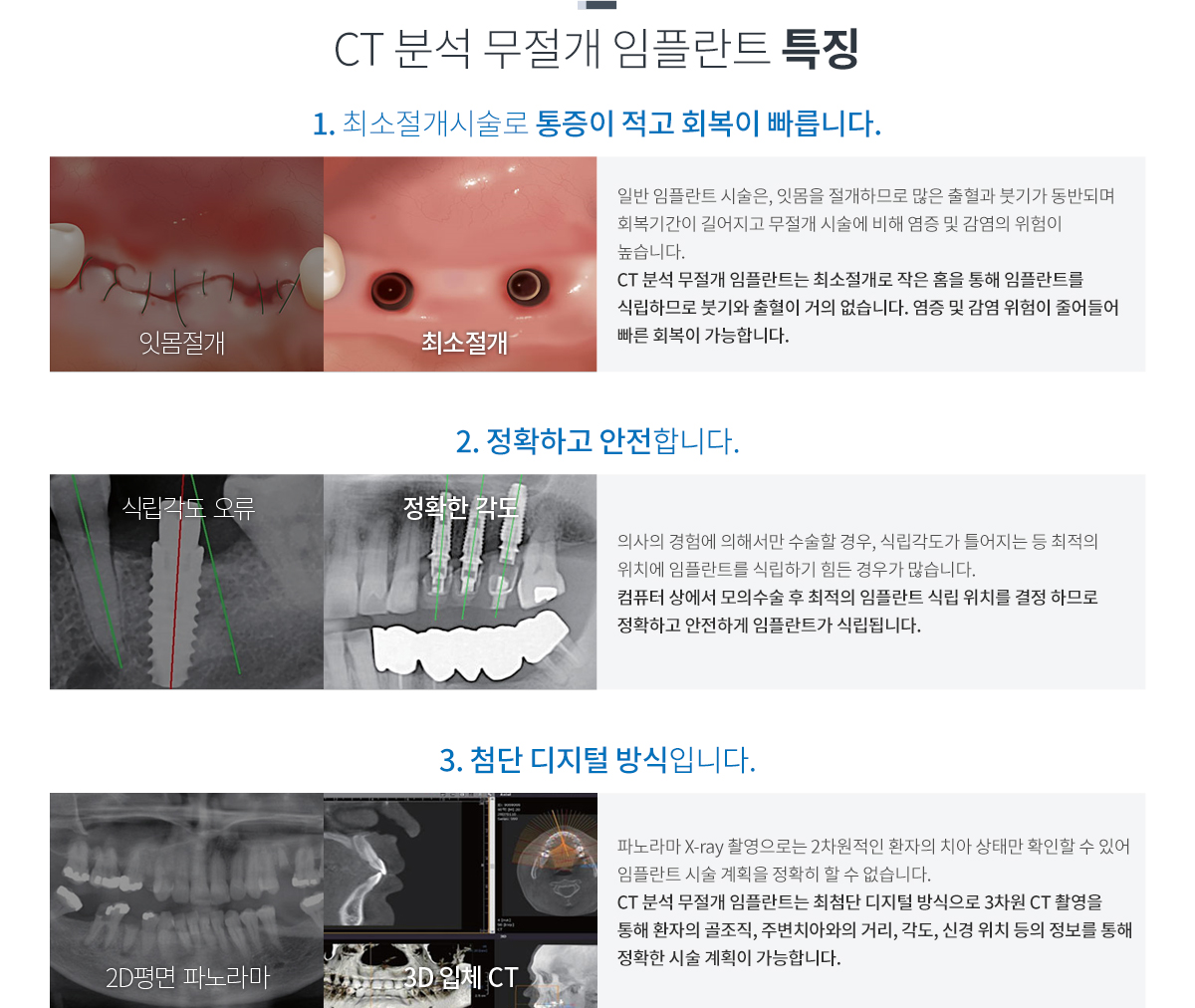 ct�м� ������ ���ö�Ʈ Ư¡