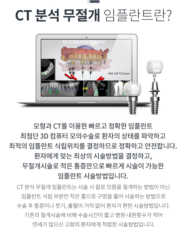 ct�м� ������ ���ö�Ʈ��