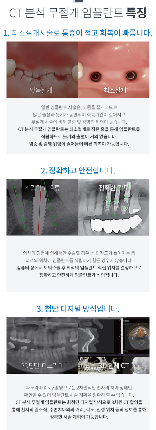 ct�м� ������ ���ö�Ʈ Ư¡